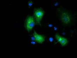 MGRN1 Antibody (clone OTI1A8)
