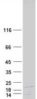 Human C1D Protein (Recombinant Myc-DDK (Flag))