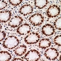 CHAF1B / CAF1 Antibody