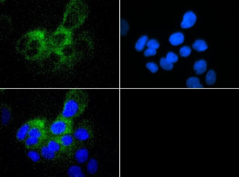 ABCB5 Antibody