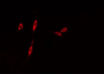 MYST2 / HBO1 Antibody