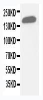 GLI2 Antibody (aa1444-1463)