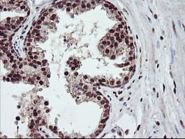 COPS5 / JAB1 Antibody (clone OTI2B12)