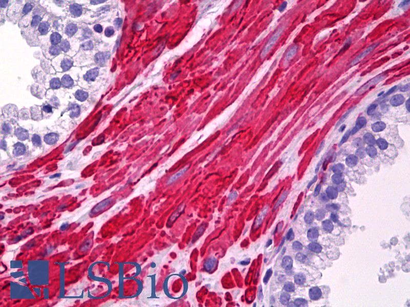 IHC-plus™ ARH / LDLRAP1 Antibody (clone 4G4-D5)