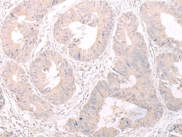 Polyclonal Rabbit anti-Human FOXRED2 Antibody (IHC)
