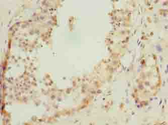 Polyclonal Rabbit anti-Human C17orf47 Antibody (IHC)
