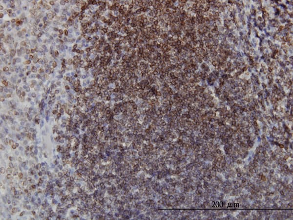 EPHB3 / EPH Receptor B3 Antibody (clone 2G9)