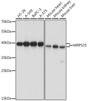 Polyclonal Rabbit anti-Human MRPS35 Antibody (IF, WB)