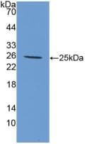 IL6 / Interleukin 6 Antibody (aa18-207)