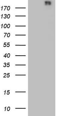 VWF / Von Willebrand Factor Antibody (aa764-1263, clone OTI9C12)