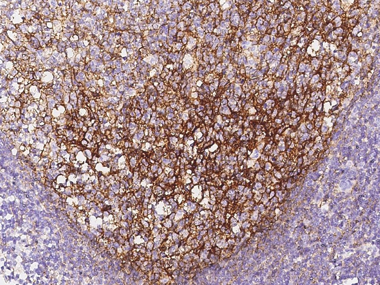 CD82 Antibody (clone 07, Preservative Free)