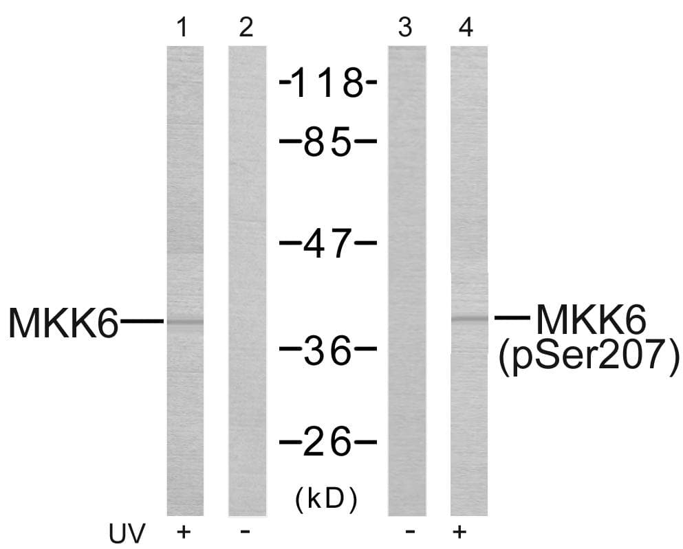 MAP2K3 / MEK3 / MKK3 Antibody (phospho-Ser189)