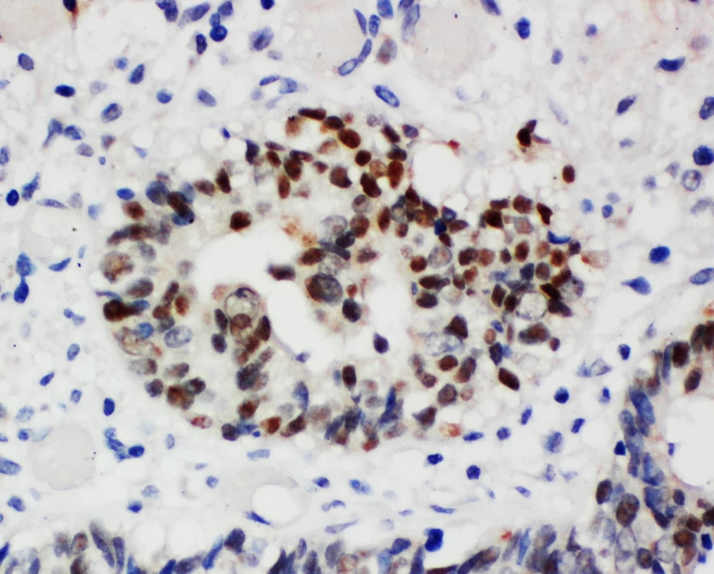 Polyclonal Rabbit anti-Human NPM1 / NPM / Nucleophosmin Antibody (aa22-41, IHC, WB)