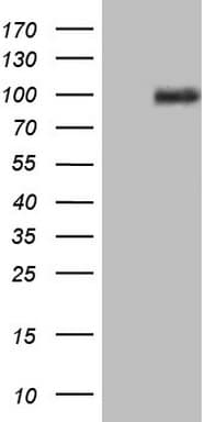 PKD3 / PRKD3 Antibody (aa300-508, clone OTI4G6)
