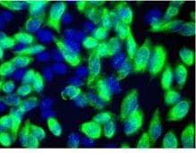 Monoclonal Mouse MYC / c-Myc Antibody (aa408-432, IF, WB)