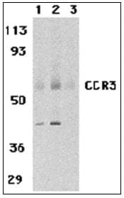 IHC-plus™ CCR3 Antibody