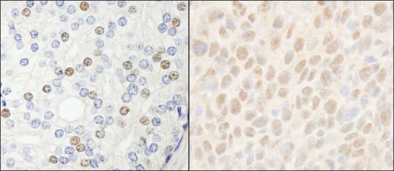 HDAC7 Antibody (aa902-952)