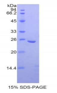 Human OSTF1 / OSF Protein (Recombinant His)