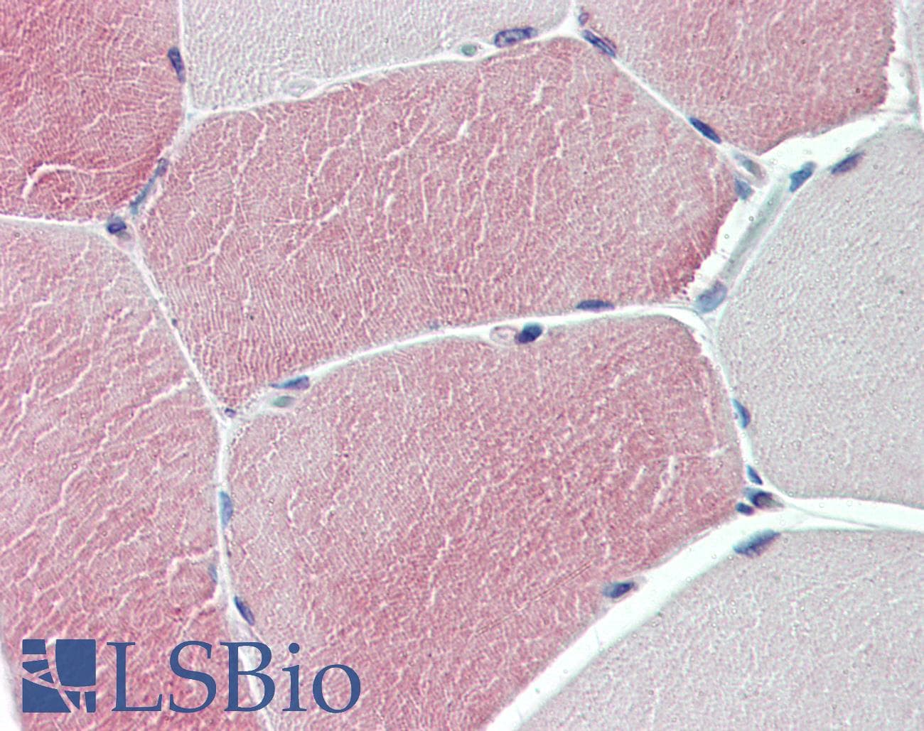 IHC-plus™ TXLNB Antibody (Internal)