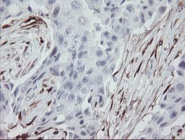 F13A1 / Factor XIIIa Antibody (clone OTI3F1)
