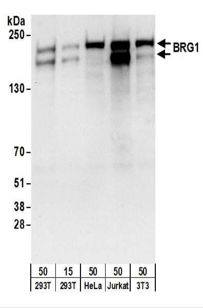 Polyclonal Goat anti-Human SMARCA4 / BRG1 Antibody (aa50-100, IHC, WB)