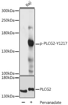 PLCG2 / PLC Gamma 2 Antibody (phospho-Tyr1217)