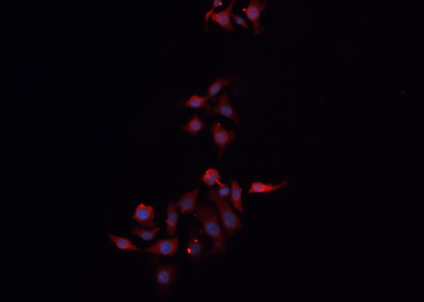 CLDN3 / Claudin 3 Antibody