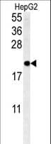 Polyclonal Rabbit anti-Human SFT2D3 Antibody (aa14-42, IHC, WB)