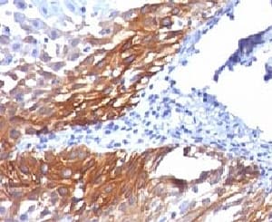 KRT17 / CK17 / Cytokeratin 17 Antibody (clone KRT17/778, Ready-to-Use)