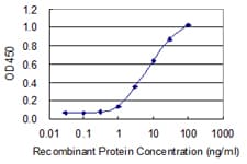CD8B / CD8 Beta Antibody (clone 4C8)
