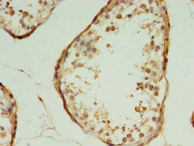 HSPC176 / TRAPPC2L Antibody