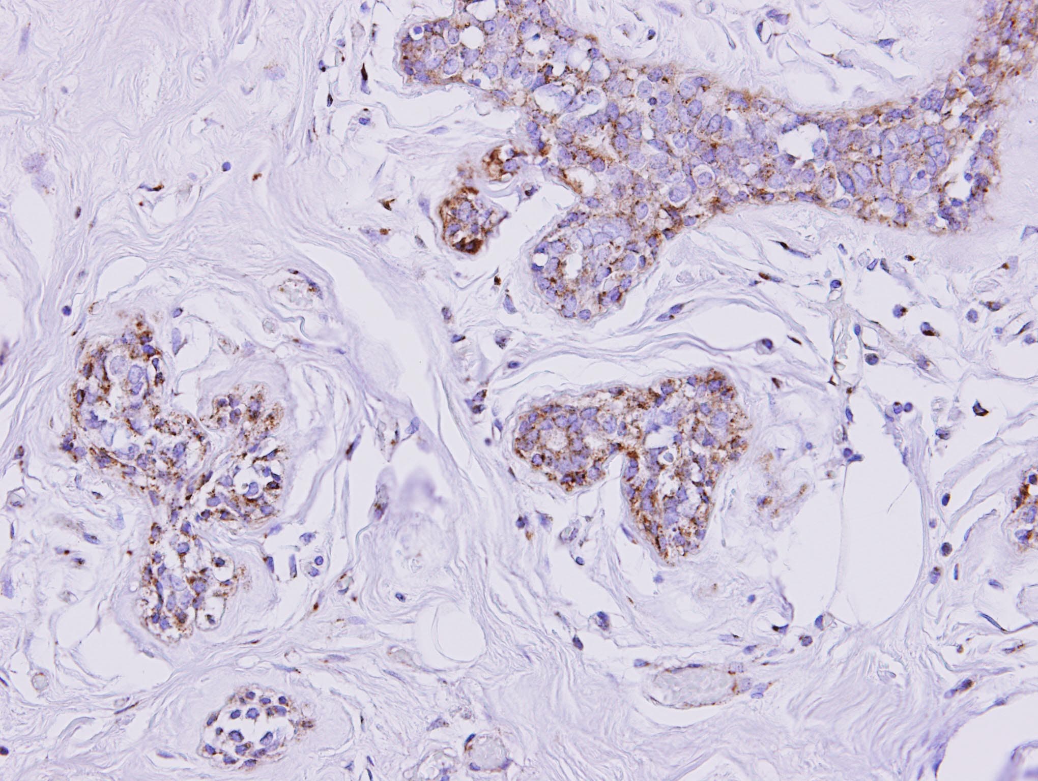 Polyclonal Rabbit anti-Human SLC25A33 Antibody (aa114-321, IHC, WB)