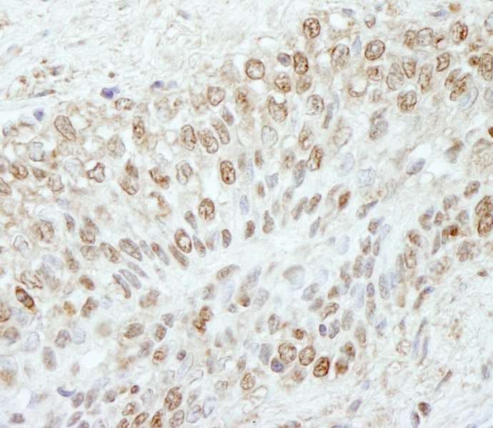 Polyclonal Rabbit anti-Human WDR91 Antibody (aa350-400, IHC)