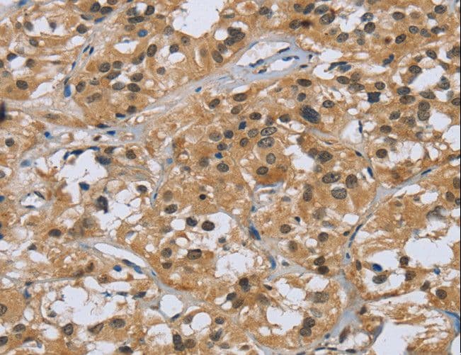 Polyclonal Rabbit anti-Human KRT5 / CK5 / Cytokeratin 5 Antibody (IHC)