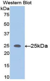 MMP11 Antibody (aa287-491)