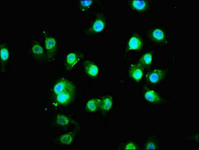Polyclonal Rabbit anti-Human FAM83G Antibody (IHC)