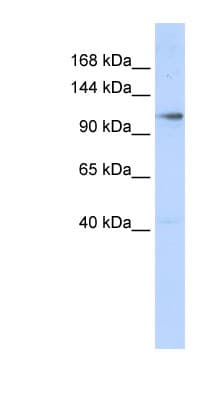 Polyclonal Rabbit anti-Human ZMIZ1 Antibody (N-Terminus, WB)