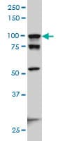IHC-plus™ Monoclonal Mouse anti-Human ACTN4 Antibody (clone 4D10, IHC, IF, WB)