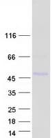 Human TP53 / p53 Protein (Recombinant Myc-DDK (Flag))