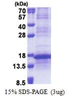 Human L35A / RPL35A Protein (Recombinant His)