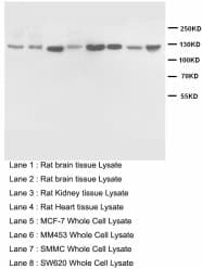 NOS2 / iNOS Antibody (aa3-24)