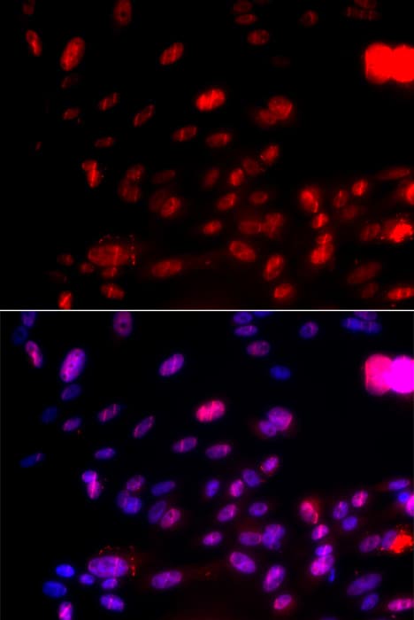CHEK1 / CHK1 Antibody (phospho-Ser317)