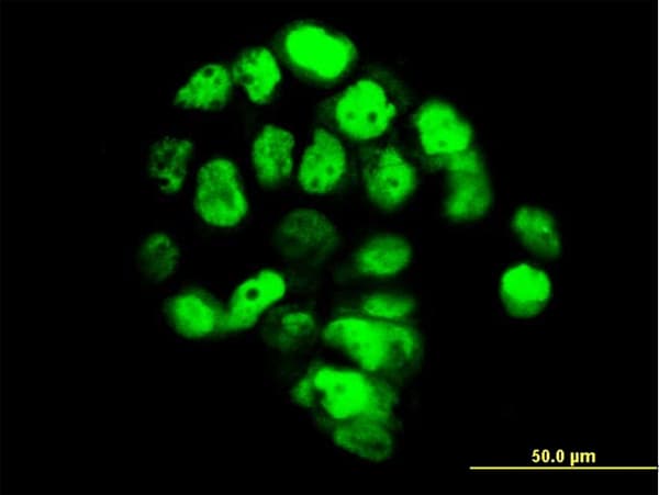 IHC-plus™ FOXA1 Antibody (clone 4F6)