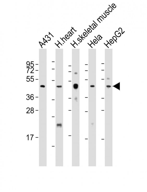 Polyclonal Rabbit anti-Human TFDP2 / DP2 Antibody (aa175-208, WB)