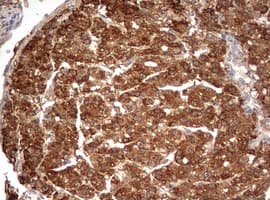 PARN Antibody (aa1-266, clone OTI4D12)