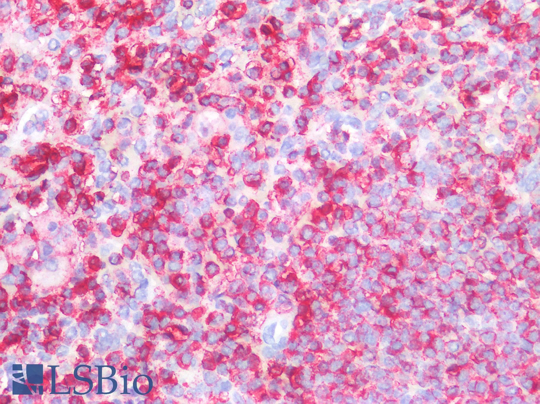 IHC-plus™ Polyclonal Rabbit anti-Human CD45 / LCA Antibody (IHC, WB)