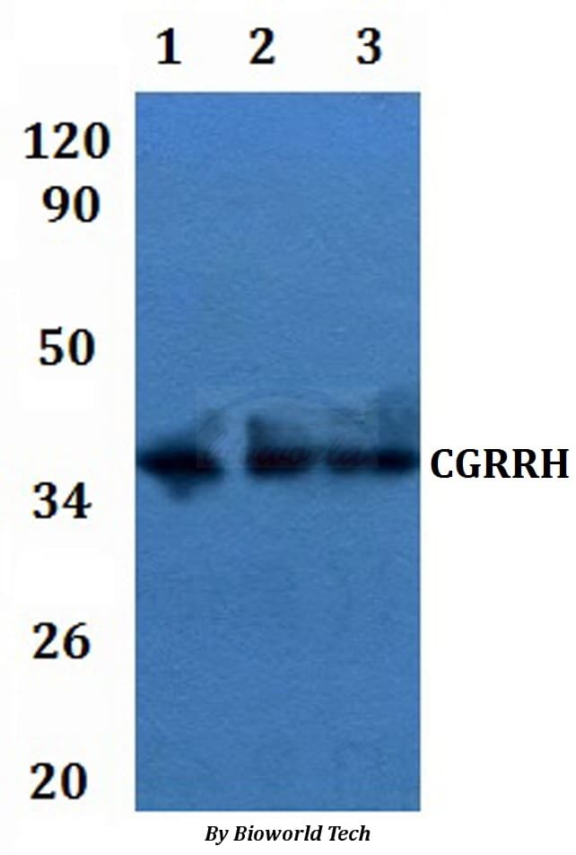 CGR19 / CGRRF1 Antibody