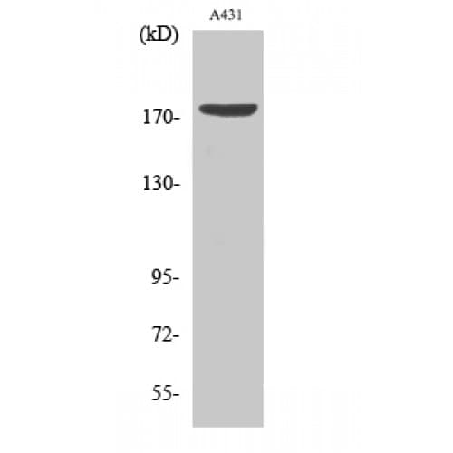 Polyclonal Rabbit anti-Human EGFR Antibody (1120-1200 aa, IHC, WB)
