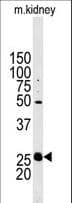 STC2 / Stanniocalcin 2 Antibody (aa16-46)