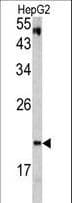 VHL / Von Hippel Lindau Antibody (aa181-210)